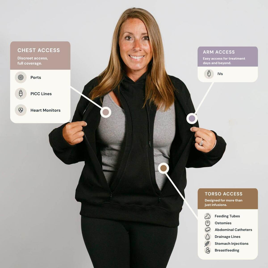 Woman wearing black hoodie demonstrating three medical access ports on chest, arm, and torso.